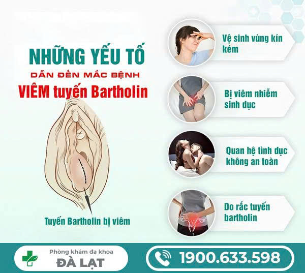 Hình ảnh minh họa